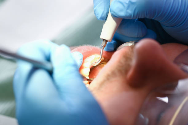 Best Urgent Care for Lost Fillings or Crowns in Brentwood, TN